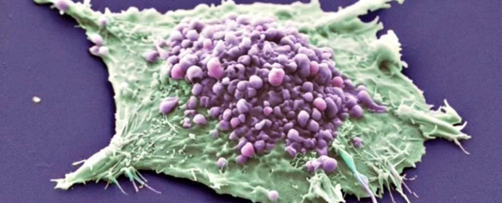 Scientists performed the first trials of a ‘universal cancer vaccine’